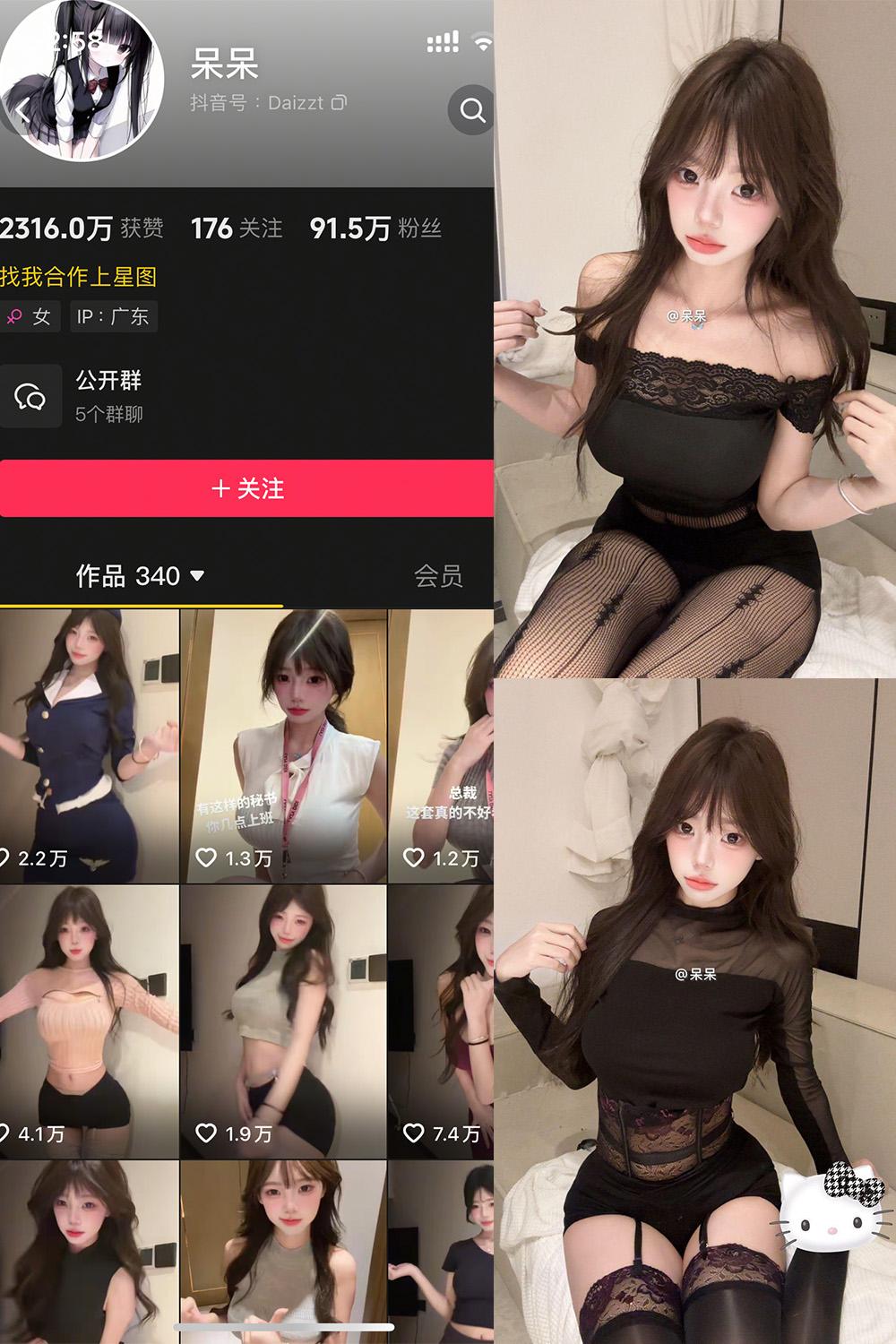 抖音 呆呆 微密圈视图 NO.007期 【8P1V】