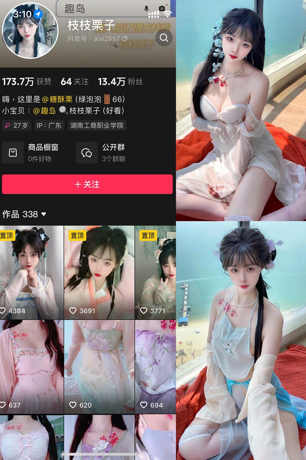 抖音 枝枝栗子 微密圈视图  NO.002期 【15P7V】