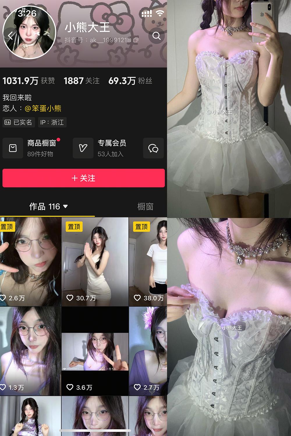 抖音 小熊大王 微密圈视图 001期 【32P】