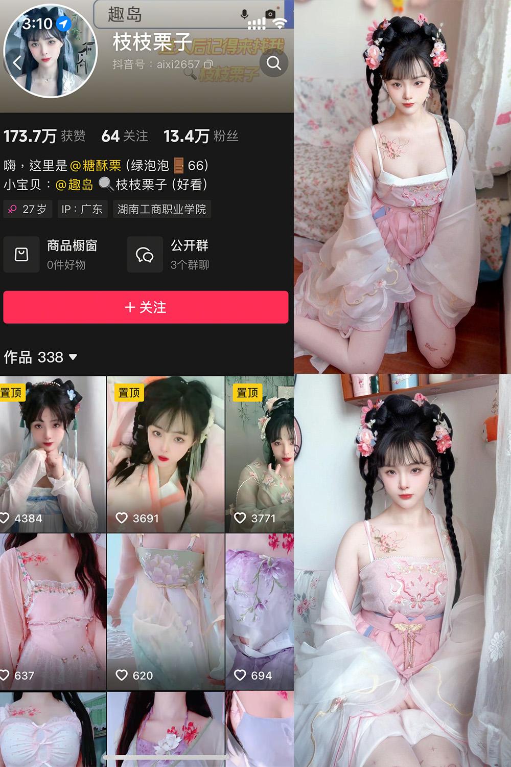 抖音 枝枝栗子 微密圈视图  NO.003期 【28P6V】